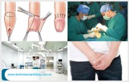 Cắt bao quy đầu có đau không?