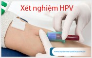 [TP.HCM] Địa chỉ xét nghiệm HPV ở đâu TPHCM uy tín?