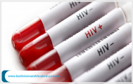 Dấu hiệu HIV sau 1 tuần ở nam giới chính xác nhất