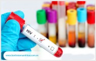 Xét nghiệm hiv ag/ab combo ở đâu?
